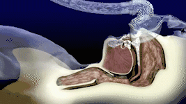 我國3000萬高血壓患者都有這毛?。∧阒绬?？